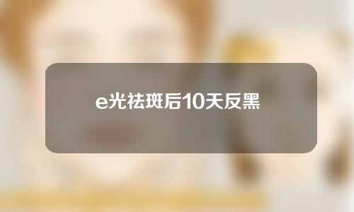 e光祛斑后10天反黑