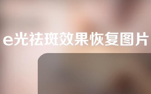 e光祛斑效果恢复图片