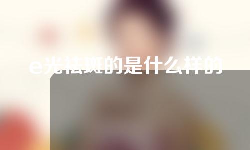 e光祛斑的是什么样的