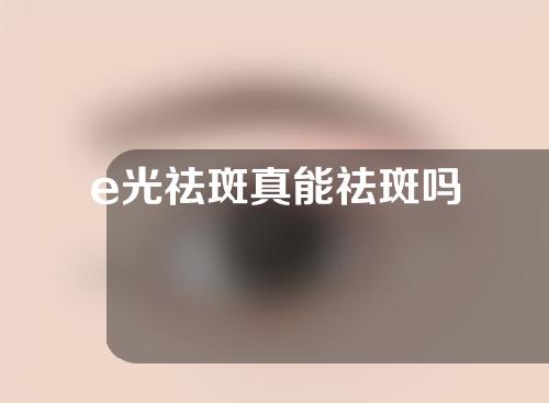 e光祛斑真能祛斑吗