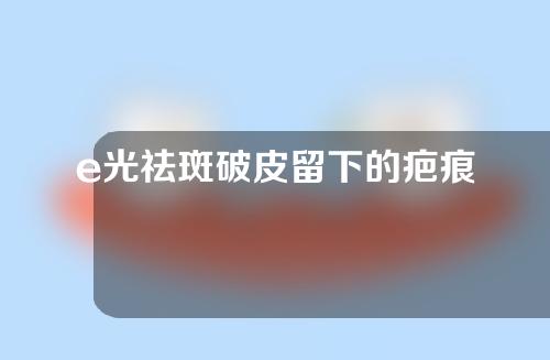 e光祛斑破皮留下的疤痕