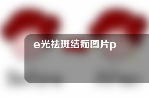 e光祛斑结痂图片p