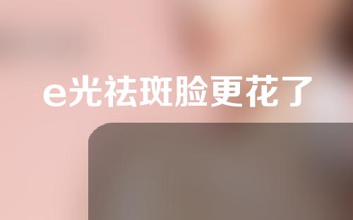 e光祛斑脸更花了