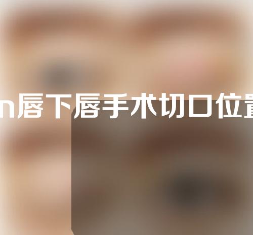 m唇下唇手术切口位置