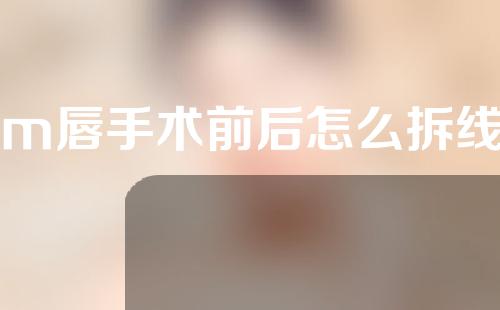 m唇手术前后怎么拆线