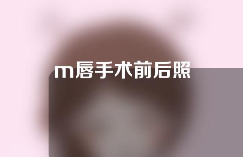 m唇手术前后照