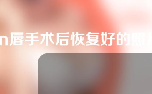m唇手术后恢复好的照片
