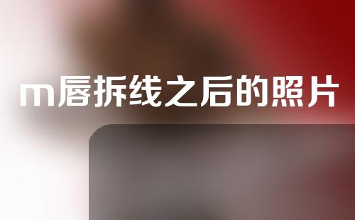 m唇拆线之后的照片