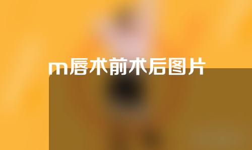 m唇术前术后图片