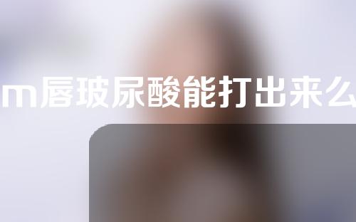 m唇玻尿酸能打出来么