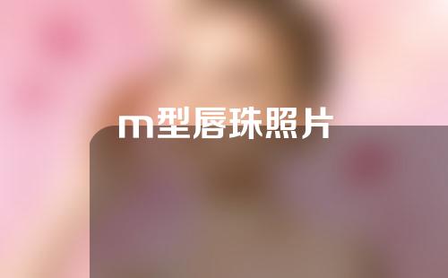 m型唇珠照片