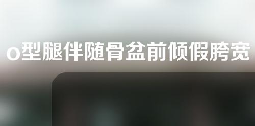 o型腿伴随骨盆前倾假胯宽先矫正哪个