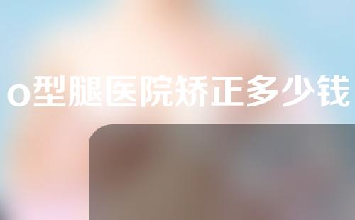 o型腿医院矫正多少钱