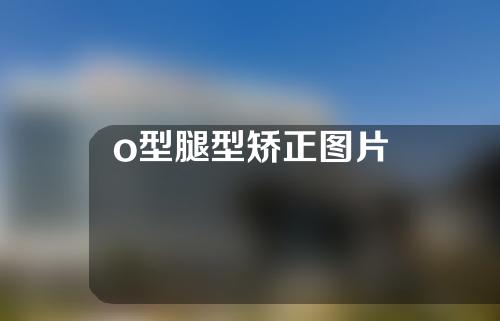 o型腿型矫正图片