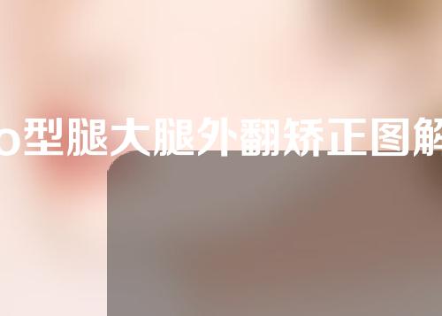 o型腿大腿外翻矫正图解