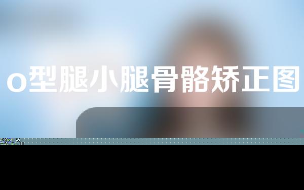 o型腿小腿骨骼矫正图