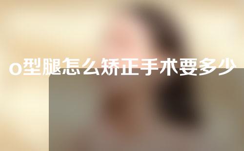 o型腿怎么矫正手术要多少钱
