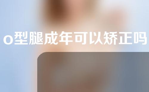 o型腿成年可以矫正吗