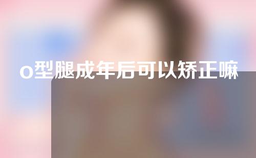 o型腿成年后可以矫正嘛