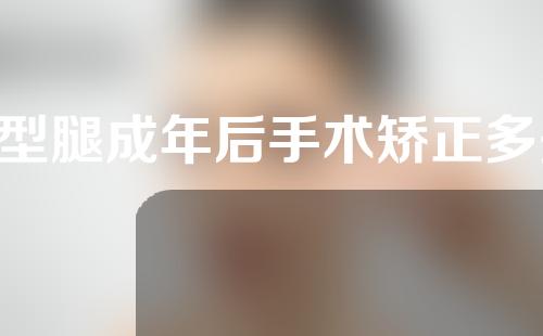 o型腿成年后手术矫正多少钱