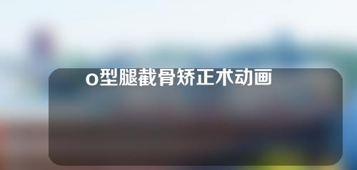 o型腿截骨矫正术动画