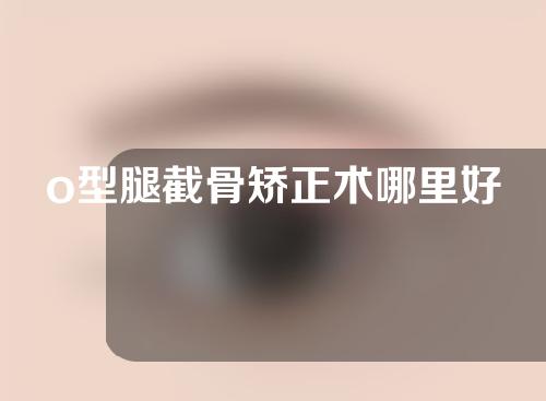 o型腿截骨矫正术哪里好