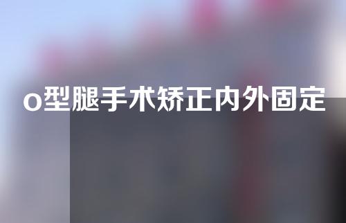 o型腿手术矫正内外固定