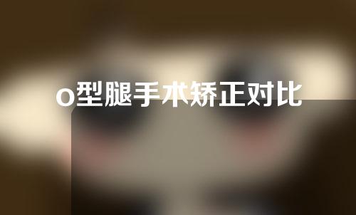 o型腿手术矫正对比