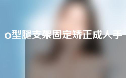 o型腿支架固定矫正成人手术广东