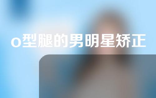 o型腿的男明星矫正