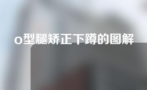 o型腿矫正下蹲的图解