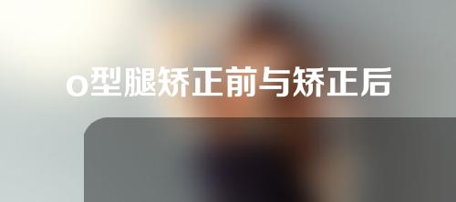 o型腿矫正前与矫正后