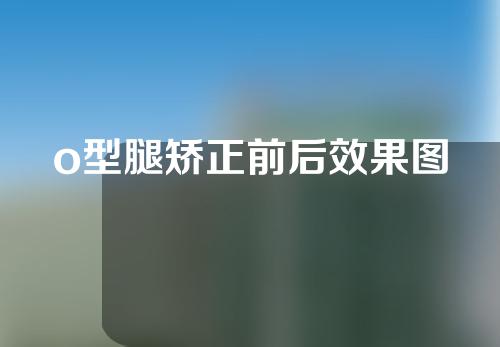 o型腿矫正前后效果图