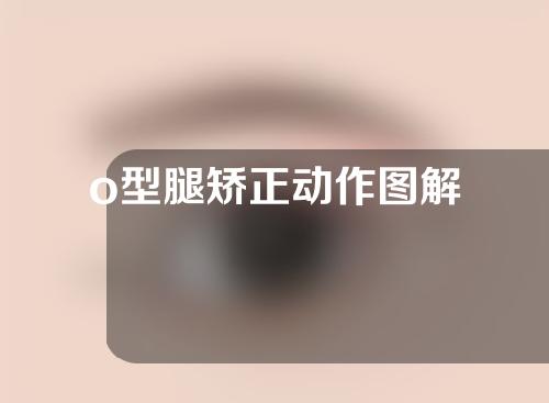 o型腿矫正动作图解