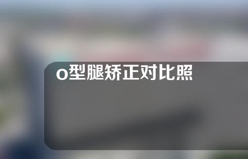 o型腿矫正对比照