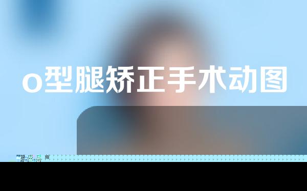 o型腿矫正手术动图