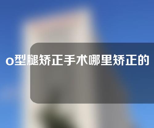 o型腿矫正手术哪里矫正的好医院