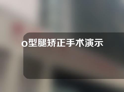 o型腿矫正手术演示