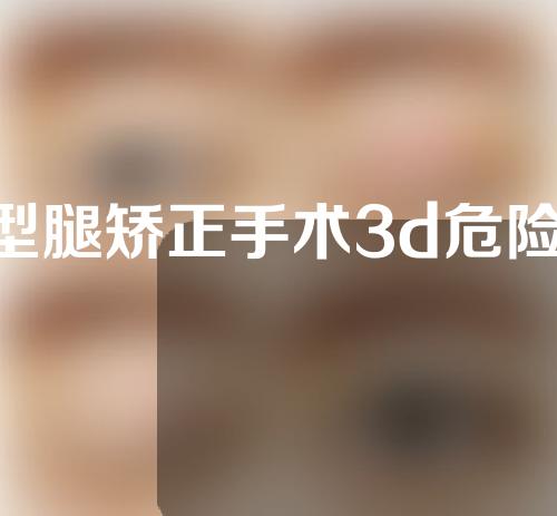 o型腿矫正手术3d危险吗