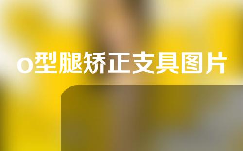 o型腿矫正支具图片