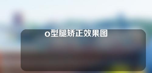 o型腿矫正效果图