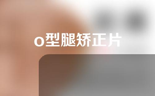 o型腿矫正片