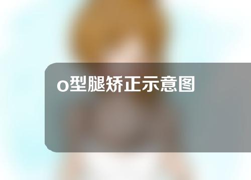 o型腿矫正示意图