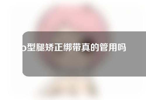 o型腿矫正绑带真的管用吗