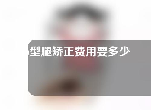 o型腿矫正费用要多少