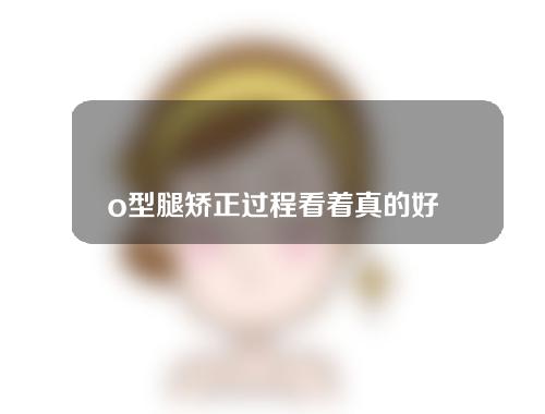 o型腿矫正过程看着真的好痛