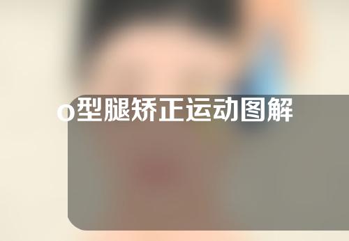 o型腿矫正运动图解