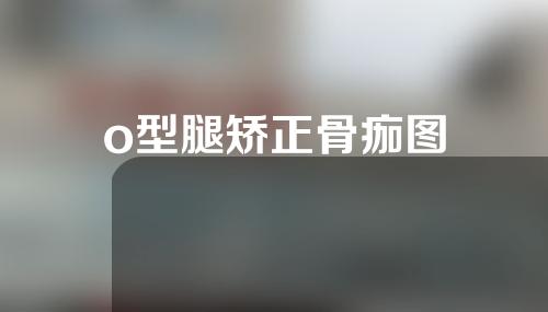o型腿矫正骨痂图