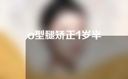o型腿矫正1岁半