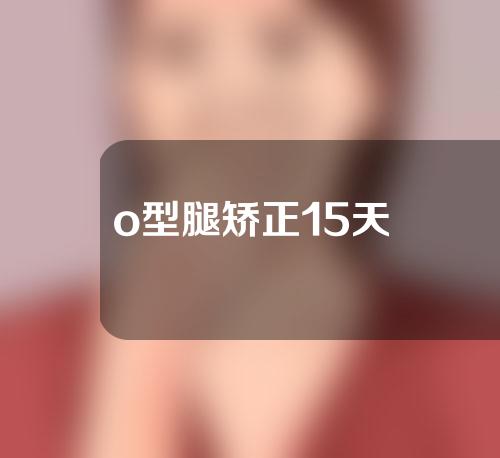 o型腿矫正15天